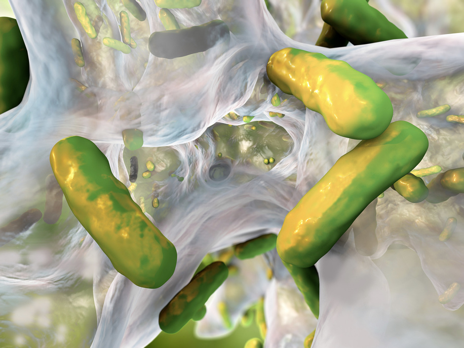 Sanierung bei Legionellen: So kann die Installation erhalten werden Sanierung bei Legionellen: So kann die Installation erhalten werden