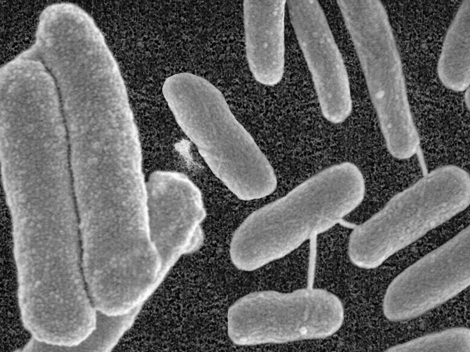 Warmwasser ohne Legionellen: Ein Filter spart Energie Warmwasser ohne Legionellen: Ein Filter spart Energie