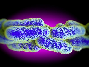 Legionellen, Bäume, Mobilfunkmasten und Garagen: 4 Urteile rund ums Wohnen